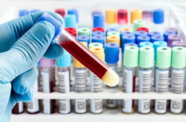 Phương pháp xét nghiệm máu mới phát hiện 8 loại ung thư khác nhau